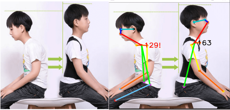 2D/3D Human Pose Estimation using Computer Vision and Machine Learning |  Upwork